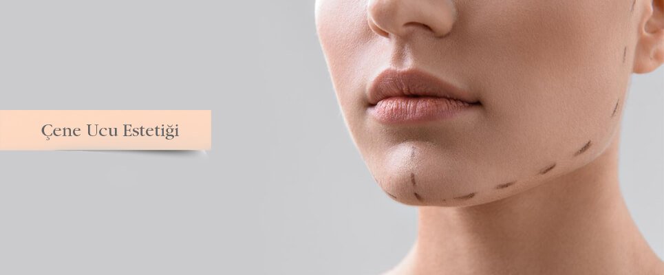 Çene Ucu Dolgu Fiyatı | WWW İstanbul