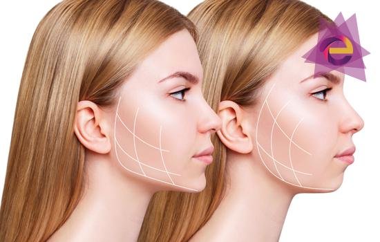 Jawline Dolgu İstanbul Fiyatları | WWW İstanbul